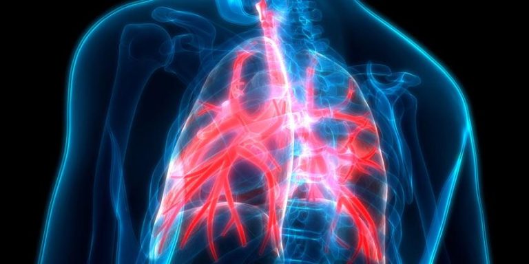Acute Bronchitis in Adults