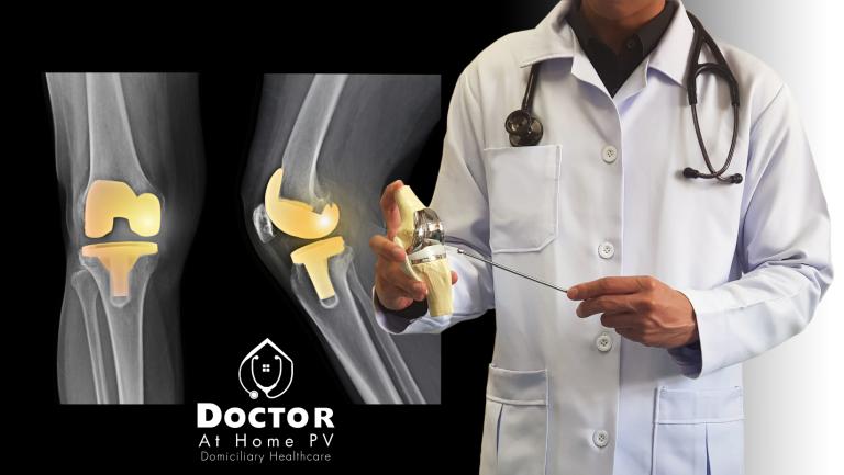 Knee Replacement in Puerto Vallarta: A Comprehensive Solution for Your Well-being
